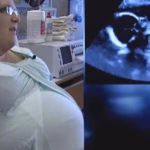 La 3 luni de la căsătorie a rămas însărcinată, dar la prima ecografie, doctorii au rămas fără cuvinte