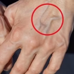 Remedii naturale pentru îmbunătățirea sănătății pielii