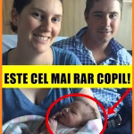 Tânăra Mămică A Născut O Fetiță Frumoasă, Sănătoasă Și Rară! Așa Ceva Se Întâmplă O Dată La 50 De Milioane De Nașteri –»