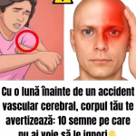 Cu o lună înainte de un accident vascular cerebral, corpul tău te avertizează: 10 semne pe care să nu le ignori