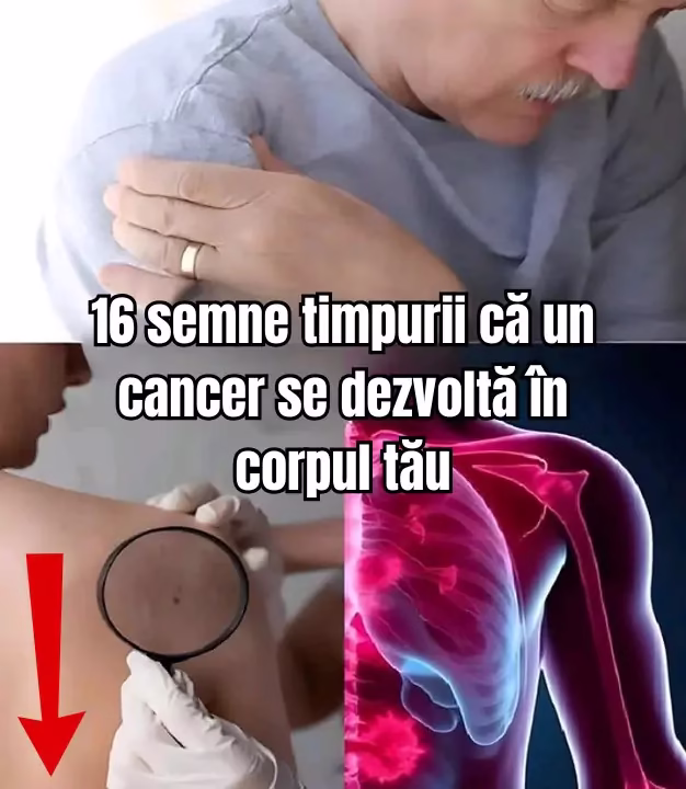 16 simptome de avertizare care pot indica apariția unui cancer în organism