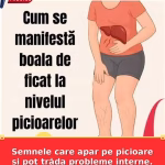 Semnele care apar pe picioare și pot trăda probleme interne. Ce nu ar trebui să ignori