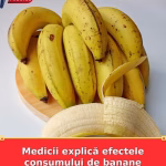 Medicii explică efectele consumului de banane asupra organismului