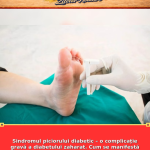 Sindromul piciorului diabetic – o complicație gravă a diabetului zaharat. Cum se manifestă și cum poate fi prevenită amputarea