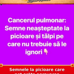 Semnele la picioare care pot arăta agravarea cancerului pulmonar
