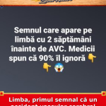 Limba, primul semnal că un accident vascular cerebral poate fi iminent