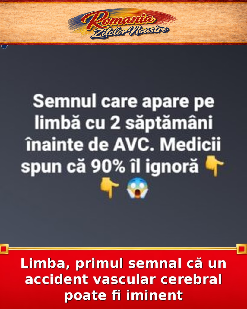 Limba, primul semnal că un accident vascular cerebral poate fi iminent