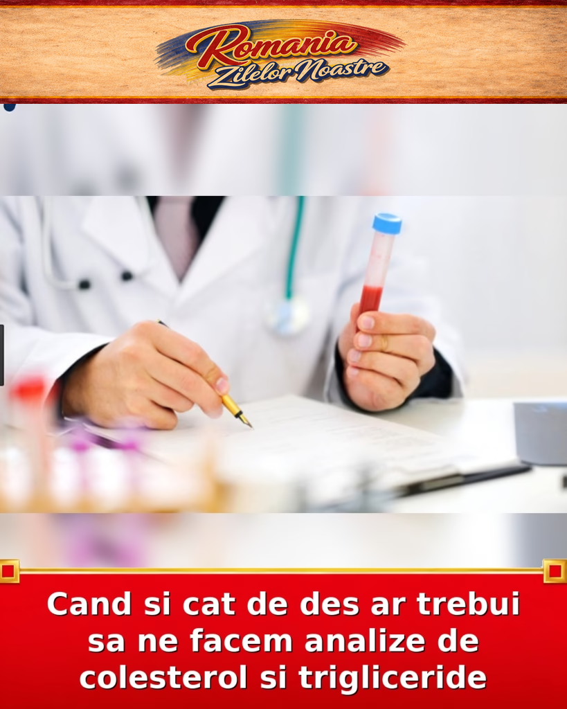 Cand si cat de des ar trebui sa ne facem analize de colesterol si trigliceride