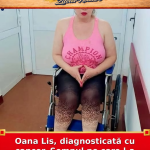 Oana Lis, diagnosticată cu cancer. Semnul pe care l-a ignorat ani de zile